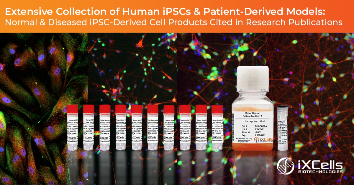 Enhance Your Neurological Research with IPSC-Derived Cells for Disease Modeling, Primary Cells, Neuronal Assays, Reprogramming, Gene Editing, and more 267